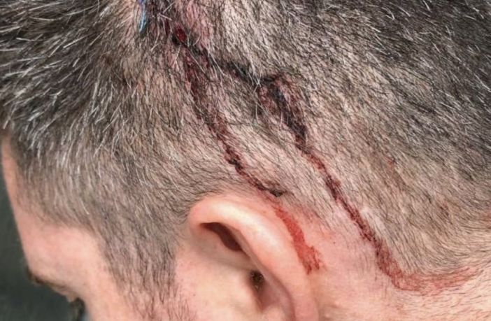 A member of Celtic's coaching staff hit by a glass at Ibrox in April 2022