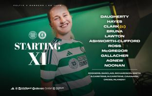 Celtic Team News