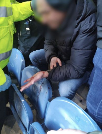A Celtic supporter's head split open at Ibrox