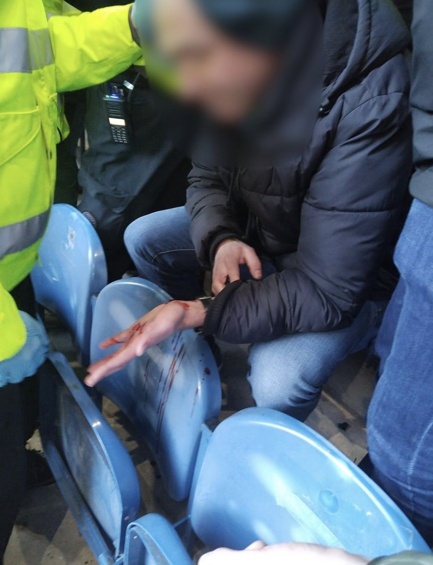 A Celtic supporter's head split open at Ibrox