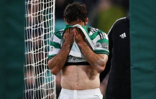 Marcelo Saracchi of Celtic leaves the field injured